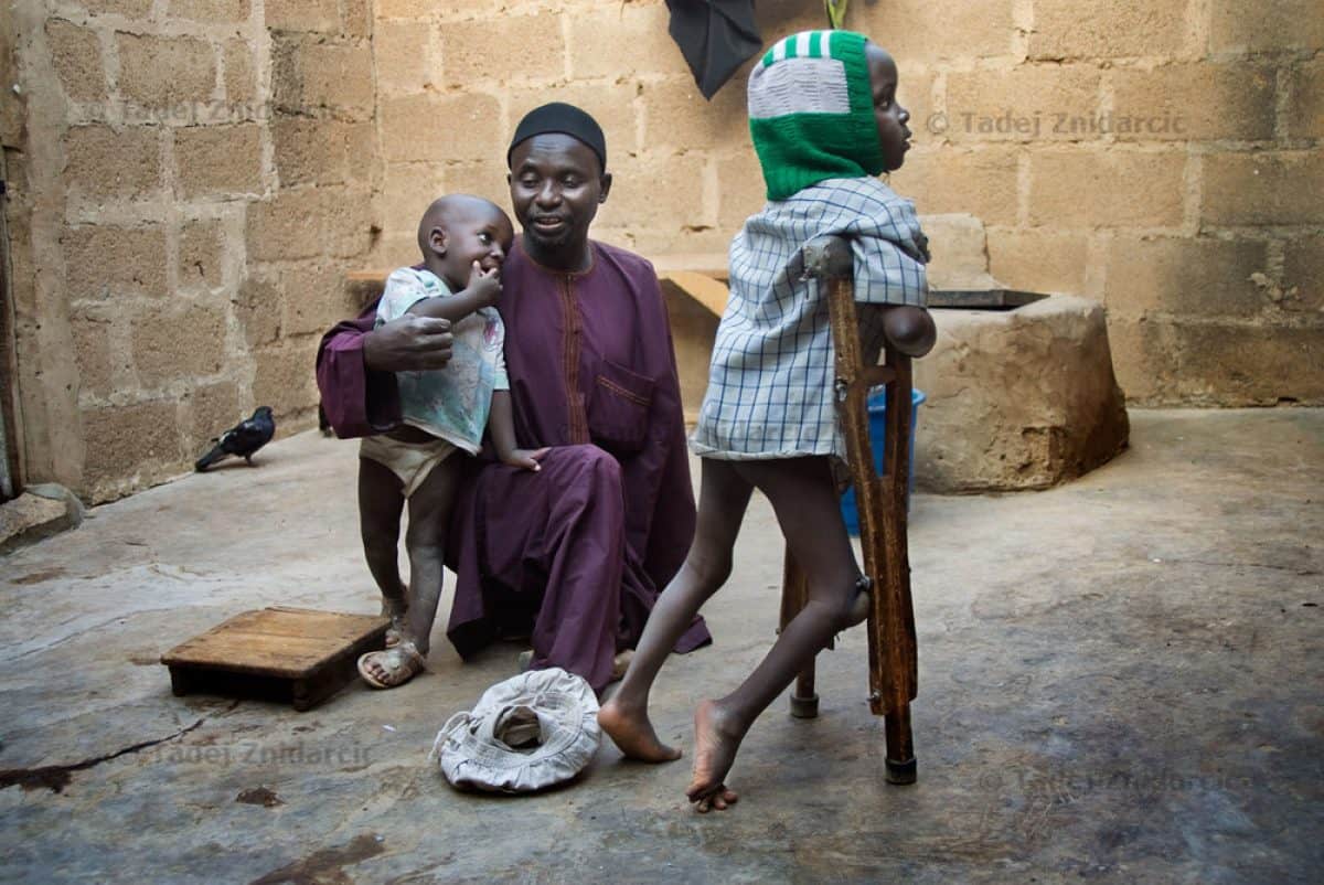 Polio Ravages Nigeria As Bauchi Records 38 Fresh Cases
