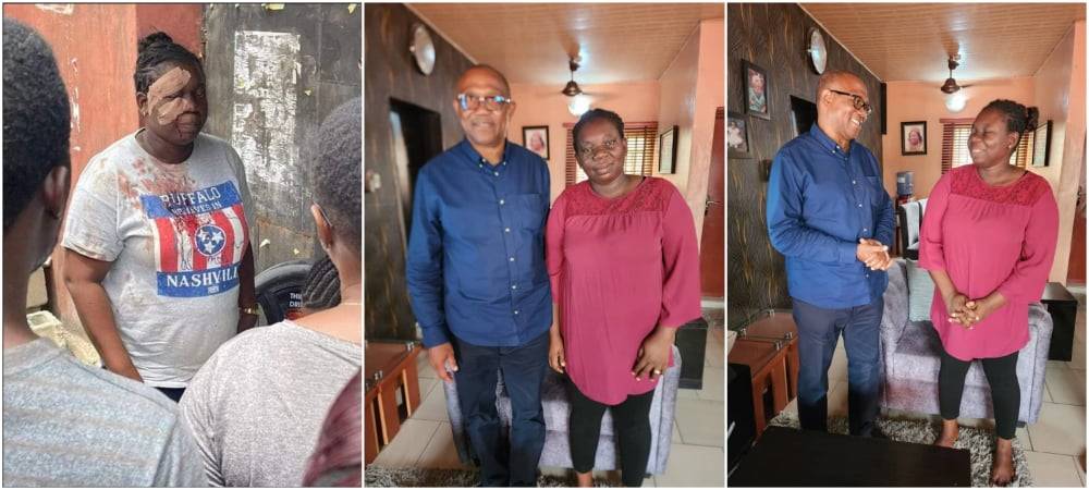She is An Icon of Democracy –Peter Obi Visits Victim of Attack During the Presidential Election in Lagos.